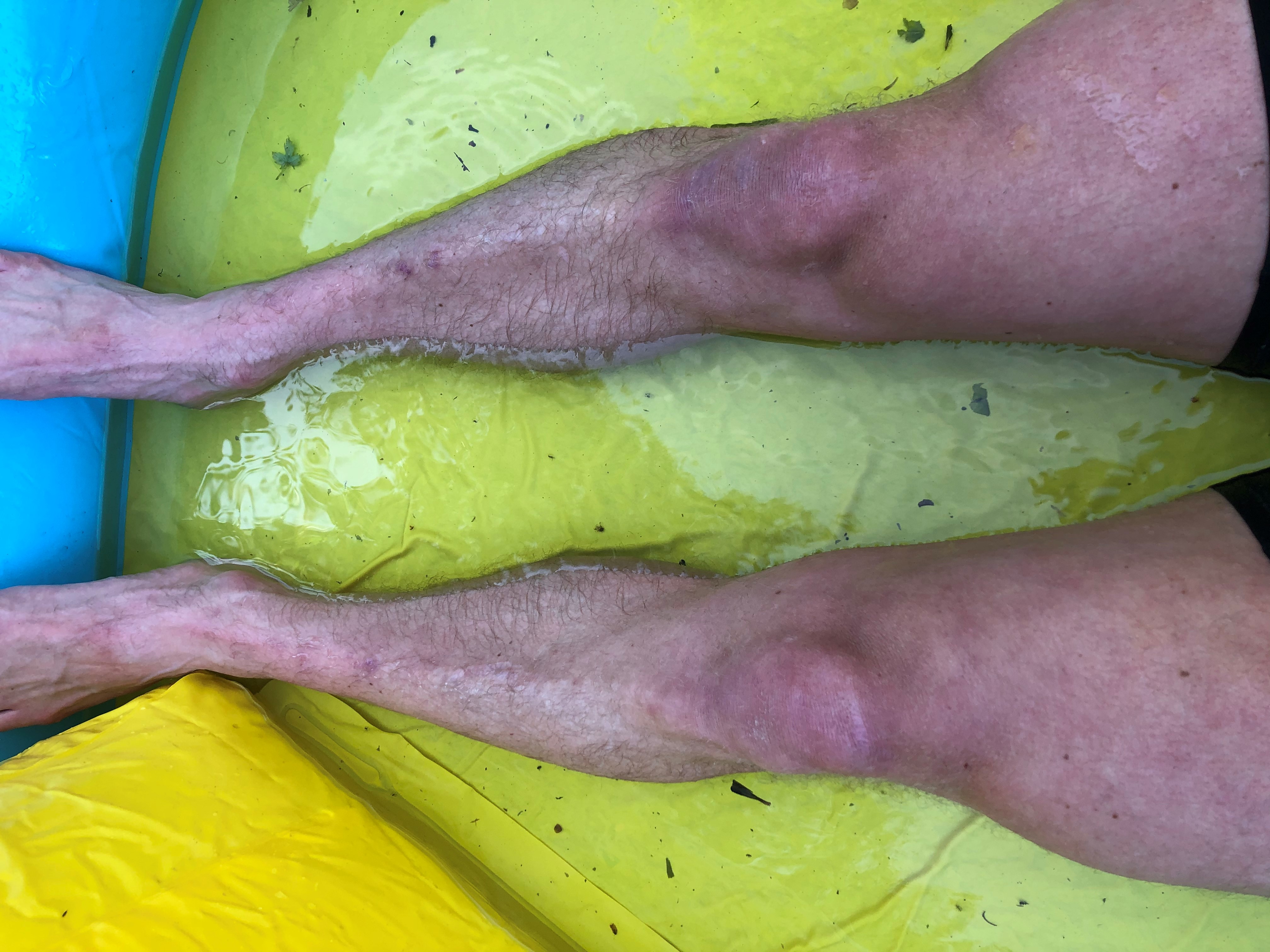 Knees in paddling Pool (ice added)